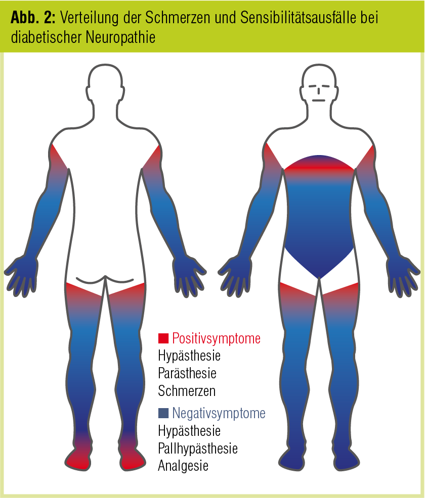 Periphere Diabetische Polyneuropathie | Diabetes Forum | MedMedia